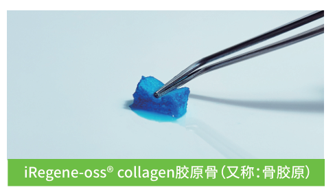 collagen膠原骨（又稱：骨膠原）
